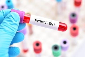 I Got a Cortisol Blood Stress Test. Here's What I Learned and How It Affected My Lifestyle