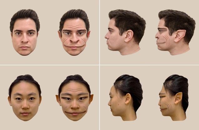 Haunting 'Demon Faces' Show What It's Like to Have Rare Distorted Face Syndrome