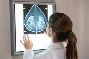 What Is Breast Density, and Why Do You Need to Know Yours?